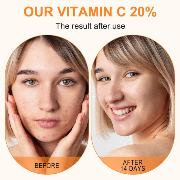 Vitamin C Serum